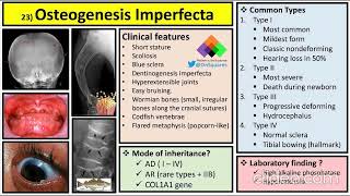 Osteogenesis imperfecta clinical features diagnosis and management [upl. by Nanaek]