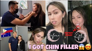 OH MY I GOT CHIN FILLER  BEFORE amp AFTER SHOTS  EVERYTHING YOU NEED TO KNOW Pinay in Australia [upl. by Malliw]