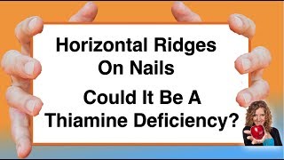 Could horizontal ridges on nails be a Thiamine deficiency With Karen Langston [upl. by Rodablas]