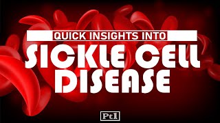 Quick Insights Into Sickle Cell Disease Pt01 [upl. by Ecart]