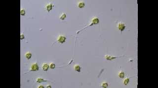 Cytoplasmic movement between cells of Chlorarachniophyte クロララクニオン藻の細胞間における原形質の移動 [upl. by Eneryt]