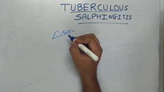 Tuberculous Salphingitis [upl. by Ahsatal]