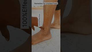 Remove deadskin naturally  salon like body polish at home shorts skincare youtube [upl. by Lehcyar]