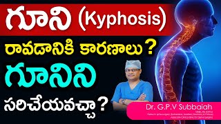 What is Kyphosis Can Kyphosis be corrected  I Kyphosis I scoliosis treatment I Dr GPV Subbaiah [upl. by Nauqel850]