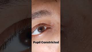 Pupil Constricted light response 😲😲😲 mbbs trending ytshorts [upl. by Huntley]