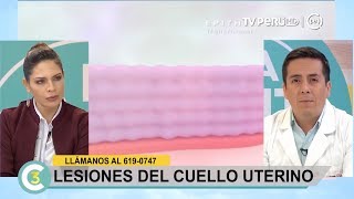 A la Cuenta de 3  Lesiones del cuello uterino  28062017 [upl. by Asimaj]