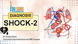 Want to Master Shock diagnosis Watch This Now  types of shock  Part 2 [upl. by Ileyan]