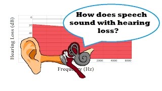 How Does Speech Sound with Hearing Loss [upl. by Acirre430]