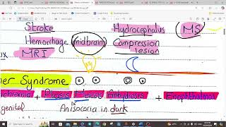 NEUROOPTHALMOLOGY PART I  OPTHALMOLOGY  5TH YEAR [upl. by Animrelliug91]