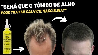 TÔNICO DE ALHO SERVE PARA TRATAR CALVÍCIE MASCULINA [upl. by Netsrejk978]