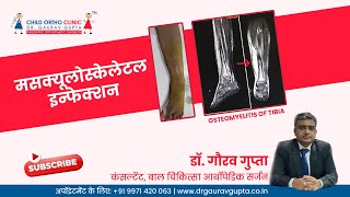 मसक्यूलोस्केलेटल इन्फेक्शन  Dr Gaurav Gupta  Child Orthopedic Surgeon in Delhi [upl. by Ahsinnor297]