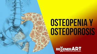 Osteopenia y Osteoporosis [upl. by Ahslek661]