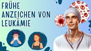 10 Frühe Anzeichen von Leukämie die du kennen musst [upl. by Elvie150]