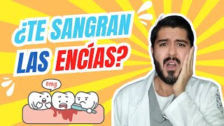 ¿Gingivitis o Periodontitis Como prevenir la enfermedad de las encías [upl. by Ahsaya]