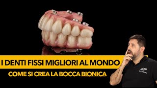 Le migliori protesi dentali al mondo  La Bocca bionica [upl. by Zippel]