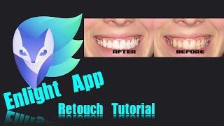 Enlight iPhone App  Teeth Whitening [upl. by Redle236]