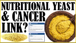 Nutritional Yeast And Cancer Is There A Link [upl. by Nisen]