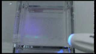 Agarose gel electrophoresis of proteins [upl. by Campney65]