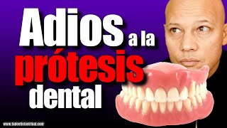 LA MEJOR FORMA de REEMPLAZAR TU PROTESIS DENTAL sin TENER MUCHO HUESO en las ENCÍAS [upl. by Eeleak]