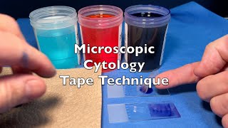 Microscopic Cytology Tape Technique [upl. by Kreda]