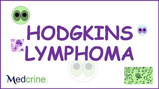 Hodgkins Lymphoma Pathophysiology symptoms and treatment [upl. by Orfurd707]