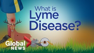 Why Lyme disease is on the rise explained [upl. by Trebleht]