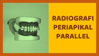 Teknik Radiografi Intraoral Periapikal Parallel Radiologi Dental [upl. by Livvy]