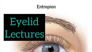 Eyelid lectures part 2 Eye lectures ophthalmology jatoi eyelectures eyelid eyedetaillecture [upl. by Llirpa]