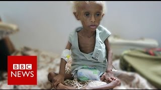 Yemen On the brink of starvation  BBC News [upl. by Ellata923]