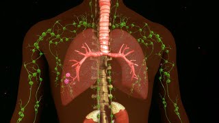 Clinical Charactesistics and Surgical Treatment of Chylothorax [upl. by Raimondo43]