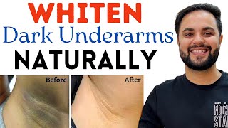 5 Natural Ways to Whiten Dark Underarms at Home in 7 Days [upl. by Omsare]