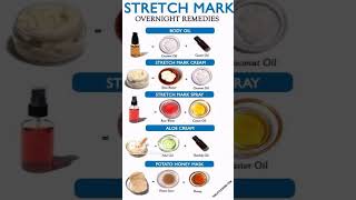 Stretch mark overnight remedies  simple and healthy tips [upl. by Lasala]