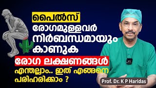 പൈൽസ് രോഗമുള്ളവർ നിർബന്ധമായും കാണുക  Piles Treatment Malayalam  Dr K P Haridas [upl. by Nylrehc261]