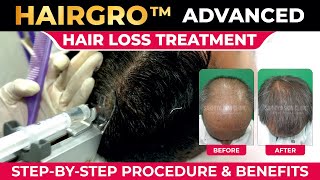 Hairgro Advanced Hair Loss Treatment StepbyStep Procedure amp Benefits  Sakhiya Skin Clinic [upl. by Ruttger947]