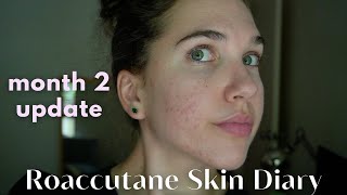 Roaccutane Daily Skin Diary  Month 2  The Purge Begins Low Dose [upl. by Collette]