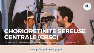 Choriorétinite séreuse centrale CRSC Pole Ophtalmologique [upl. by Ahsinyd]