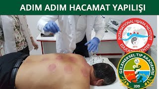 Hacamat Sırları3 Ön Vakumlama incelikleri DrN Süleyman Gök [upl. by Ennovaj788]