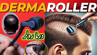 Microneedling  Derma Rolling for Hair Regrowth  Derma Roller Side Effects [upl. by Aivatnwahs]