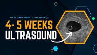 4 Weeks Pregnant  What is happening to your baby  Ultrasound [upl. by Tad177]