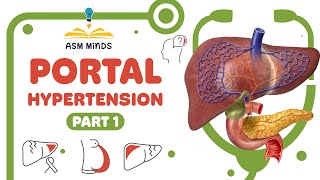 Portal Hypertension part 1 [upl. by Dabbs]