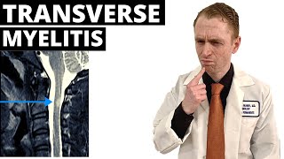 Neurologist Explains Transverse Myelitis [upl. by Arod]