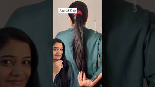 Double Hair Growth in just 28 days Pilgrim Hair Growth Serum Regrowhair clinicallytested [upl. by Mehta746]