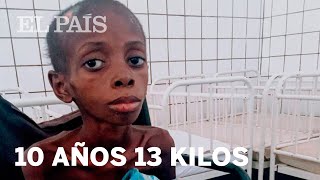 Marcos un niño desnutrido en Angola  Planeta Futuro [upl. by Gittle]