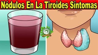 Nódulos En La Tiroides Síntomas y Tratamiento Natural Prueba Este Jugo y Bébelo De Esta Forma [upl. by Posner]