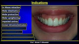 TADs 2018 Part 4 Indications English [upl. by Azenav]