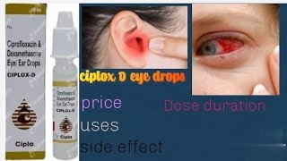 ciplox D eyes and ear drops ka istemal [upl. by Rehpotsrik]