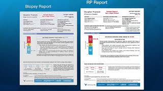 Decipher Test Report Overview [upl. by Origra]