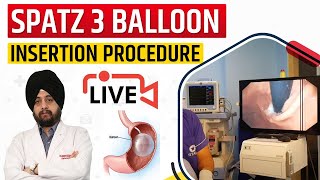 Spatz 3 Balloon Insertion Procedure Video Overview Unboxing Implantation  Orbera Balloon [upl. by Edualcnaej]