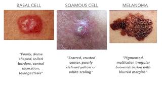 Dermatology on USMLECOMLEX [upl. by Atinob972]