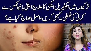 Bacterial Acne Treatment for Girls Top Tips and Tricks  Dr Sahar Chawla [upl. by Akeber]